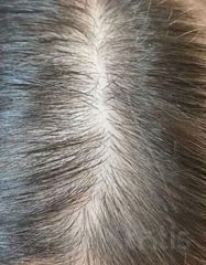 Результати Plinest Hair  фото до #1