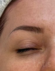 Результаты 650 Lift'Expert Wrinkle Smoother  фото после #2