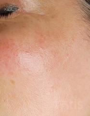 Výsledky SENSICURA Cream Mask  фото после #2