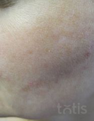 Результати 02 Me Line Caucasian Skin Day  фото после #2