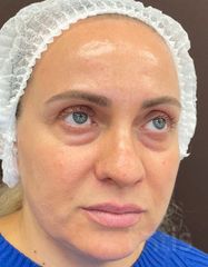 Результати 02 Me Line Caucasian Skin Day  фото до #1