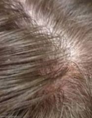 Результати Plinest Hair  фото после #2