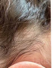 Результаты HAIR LOSS CONTROL  фото после #2