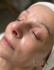 Результаты 480 Nutri'vital Mask  фото после #2