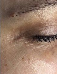 Результаты ULTIMATE EYE CORRECTOR  фото после #2