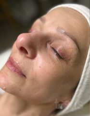 Результаты 480 Nutri'vital Mask  фото до #1