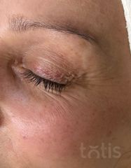 Результаты 450 Nutri'vital Eye Contour Cream  фото до #1