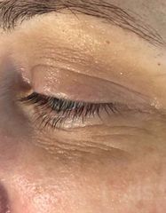 Результаты ULTIMATE EYE CORRECTOR  фото до #1