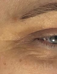 Результати EYE REVITALIZER  фото до #1