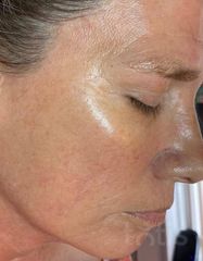 Результати Professional Tightening Protein Booster  фото после #2