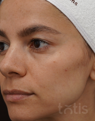 Výsledky Enzyme Peeling Mask  фото до #1