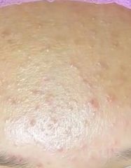 Результати AKN PEEL HRP  фото до #1