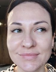Результати OXYGEN Deep Pore Masque  фото после #2