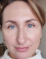 Результати Professional Peptide Perfection Exfoliator  фото до #1