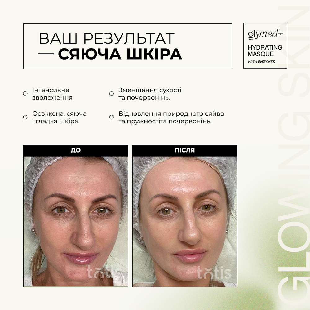 Glymed Hydrating Masque with Enzymes 30 мл: В корзину US-GM-061T - цена косметолога