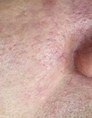 Результати Lipotrofin Ion Serum  фото после #2