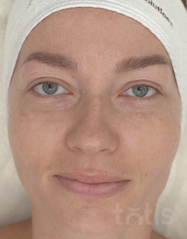 Výsledky Collagen Intensive Fleece Mask  фото после #2